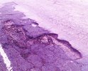 прошу помочь, даже днем выше 50 кмч ехать не возможно, ночью авто просто убивается, постоянно приходится пользоваться встречной полосой. Скоро лето, нагрузка на дорогу увеличится в разы